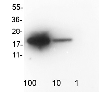 SOD1 aa 80-96 | superoxide dismutase 1, soluble (clone number 210.29) in the group Antibodies for Human/Animal / Human Proteins / Oxidative stress at Agrisera AB (Antibodies for research) (AS13 2645)